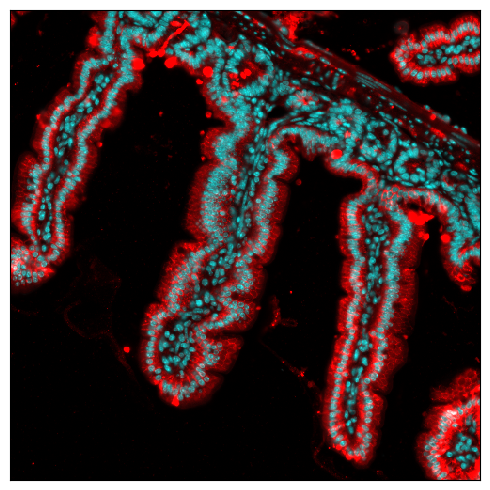 ../_images/spatial_a2-spot-based_25_0.png