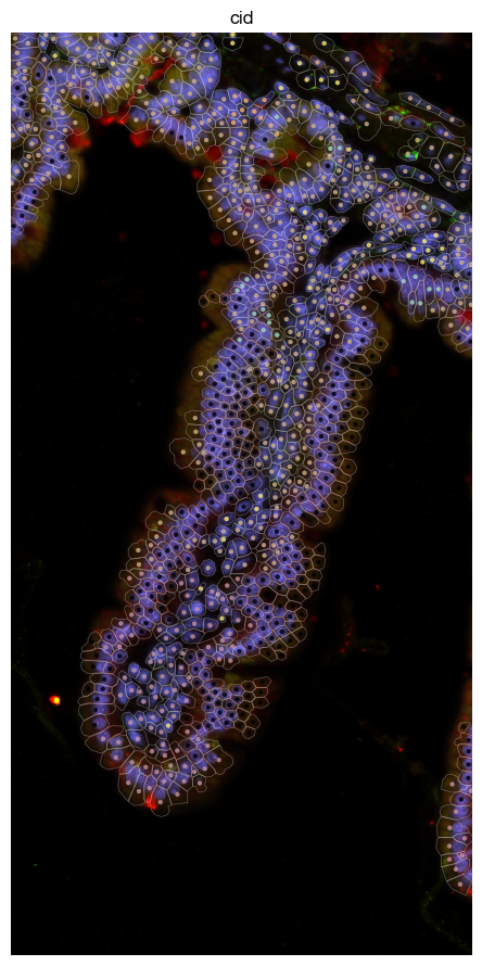 ../_images/spatial_a2-spot-based_30_0.png