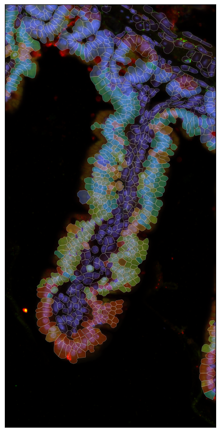 ../_images/spatial_a2-spot-based_39_0.png