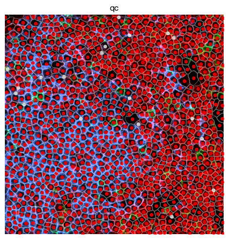 ../_images/spatial_c1-aggregate-mif_20_0.png