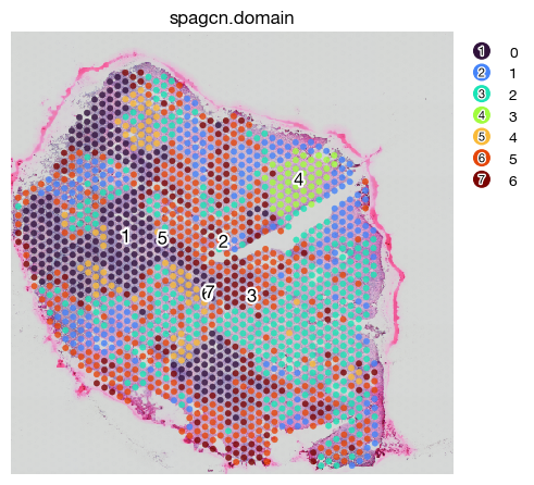 ../_images/spatial_f1-spatial-domains_18_0.png