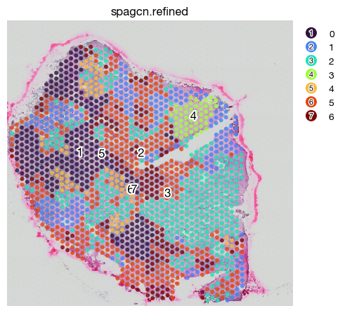 ../_images/spatial_f1-spatial-domains_19_0.png