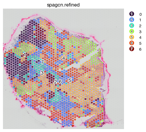 ../_images/spatial_f1-spatial-domains_23_0.png