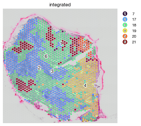 ../_images/spatial_f1-spatial-domains_34_0.png
