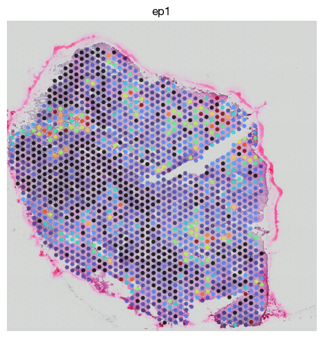 ../_images/spatial_g1-deconvolution_19_0.png