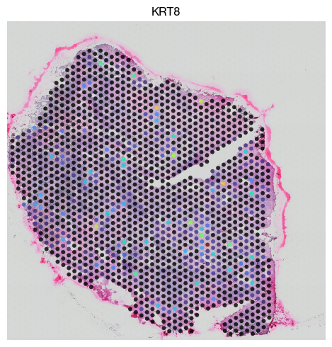 ../_images/spatial_g1-deconvolution_25_0.png